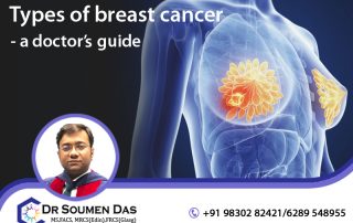 best breast cancer doctor in Kolkata