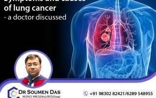 best lung cancer treatment