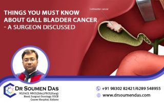 gallbladder Cancer surgeon