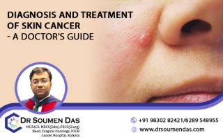 skin cancer doctor in Kolkata