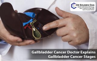 gallbladder cancer doctor