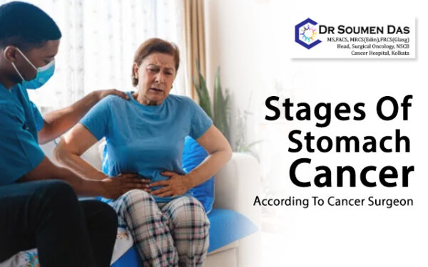 stages-of-stomach-cancer-according-to-cancer-surgeon