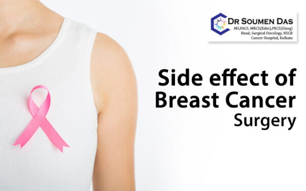 What Are The Side Effects Post Breast Cancer Surgery