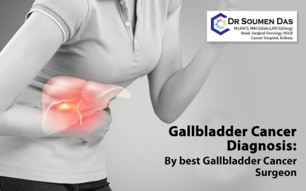 Gallbladder cancer diagnosis: By best gallbladder cancer surgeon